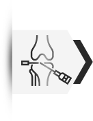 Arthroscopy in Vijayawada