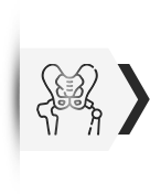 Hip Replacement Vijayawada