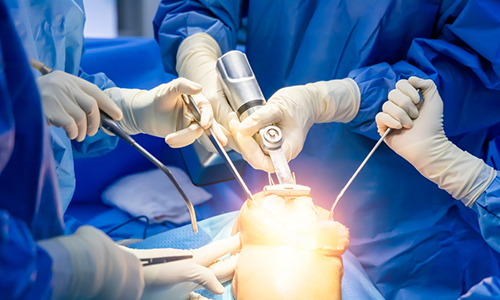 Knee replacement surgeon in vijayawada
