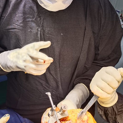 Dr Pavan K Yadav - performing knee joint replacement